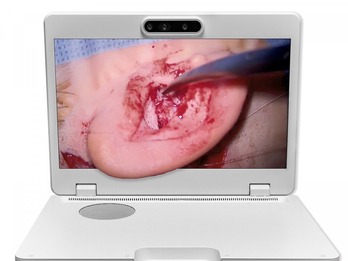 达擎之＂Heads-up 3D显微手术显示系统＂，整合4K裸眼3D显示及眼球追踪系统，具备快速追踪人眼移动位置功能，减轻医师长时间维持固定姿势的负担，让医师能有更宽广清晰的3D立体视野及更舒适的姿势来执行手术。